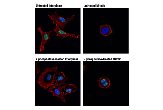 Methyl-Histone H3 (Lys9) Antibody Sampler Kit