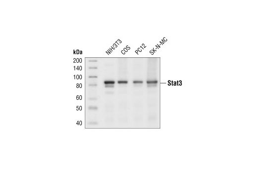 Stat3 (79D7) Rabbit mAb