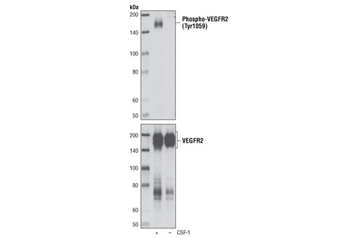 Phospho-VEGF Receptor 2 Antibody Sampler Kit