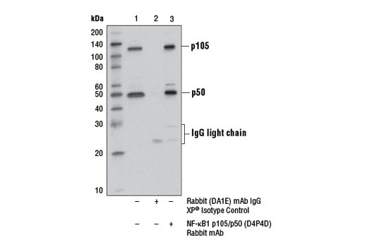 NF-kappaB Pathway Antibody Sampler Kit II