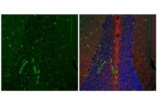 Cancer Associated Fibroblast Marker Antibody Sampler Kit