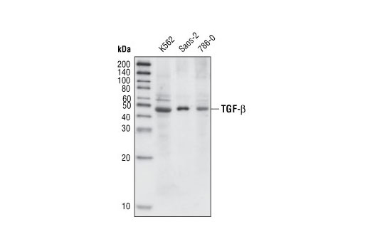 TGF-beta Fibrosis Pathway Antibody Sampler Kit