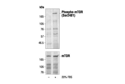 mTOR Pathway Antibody Sampler Kit