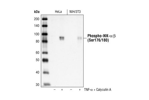 NF-kappaB Pathway Antibody Sampler Kit