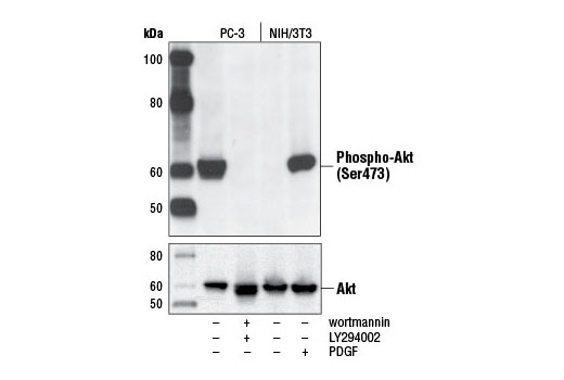 Phospho-Akt (Ser473) (D9E) XP® Rabbit mAb
