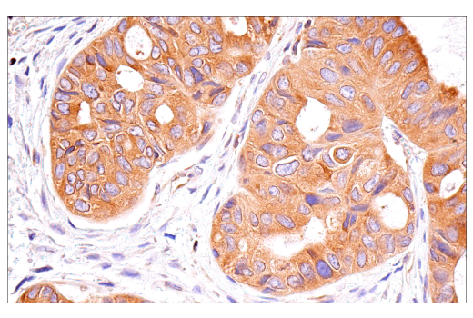 NF-kappaB Family Member Antibody Sampler Kit