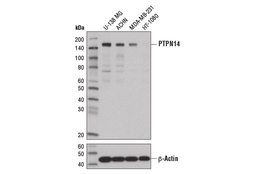 Hippo Pathway: Upstream Signaling Antibody Sampler Kit