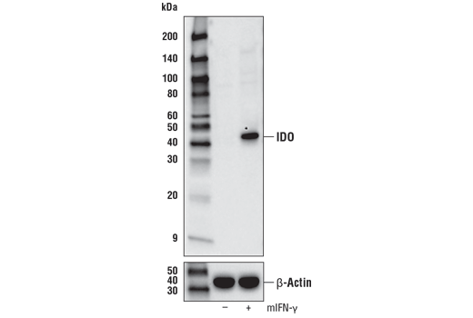 IDO (D8W5E) Rabbit mAb