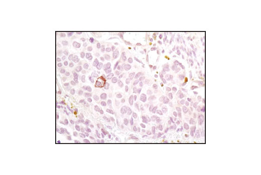 Notch Activated Targets Antibody Sampler Kit