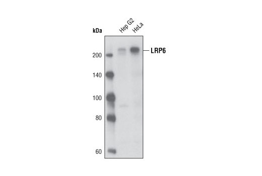 Wnt Signaling Antibody Sampler Kit