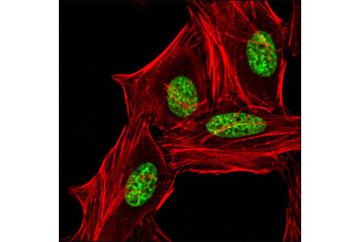 Methyl-Histone H3 (Lys9) Antibody Sampler Kit