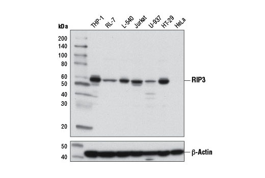 Necroptosis Antibody Sampler Kit