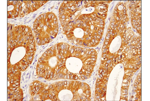 Human Reactive Cell Death and Autophagy Antibody Sampler Kit