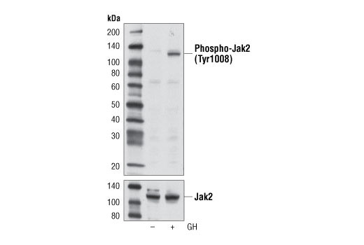 Phospho-Jak Family Antibody Sampler Kit