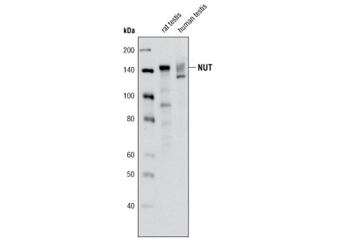 NUT (C52B1) Rabbit mAb