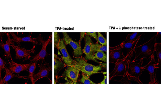 Phospho-Erk1/2 Pathway Antibody Sampler Kit