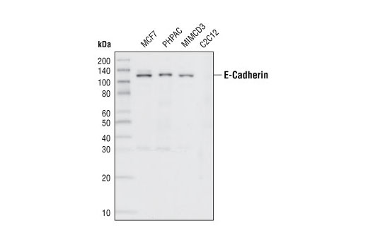 Epithelial-Mesenchymal Transition (EMT) Antibody Sampler Kit