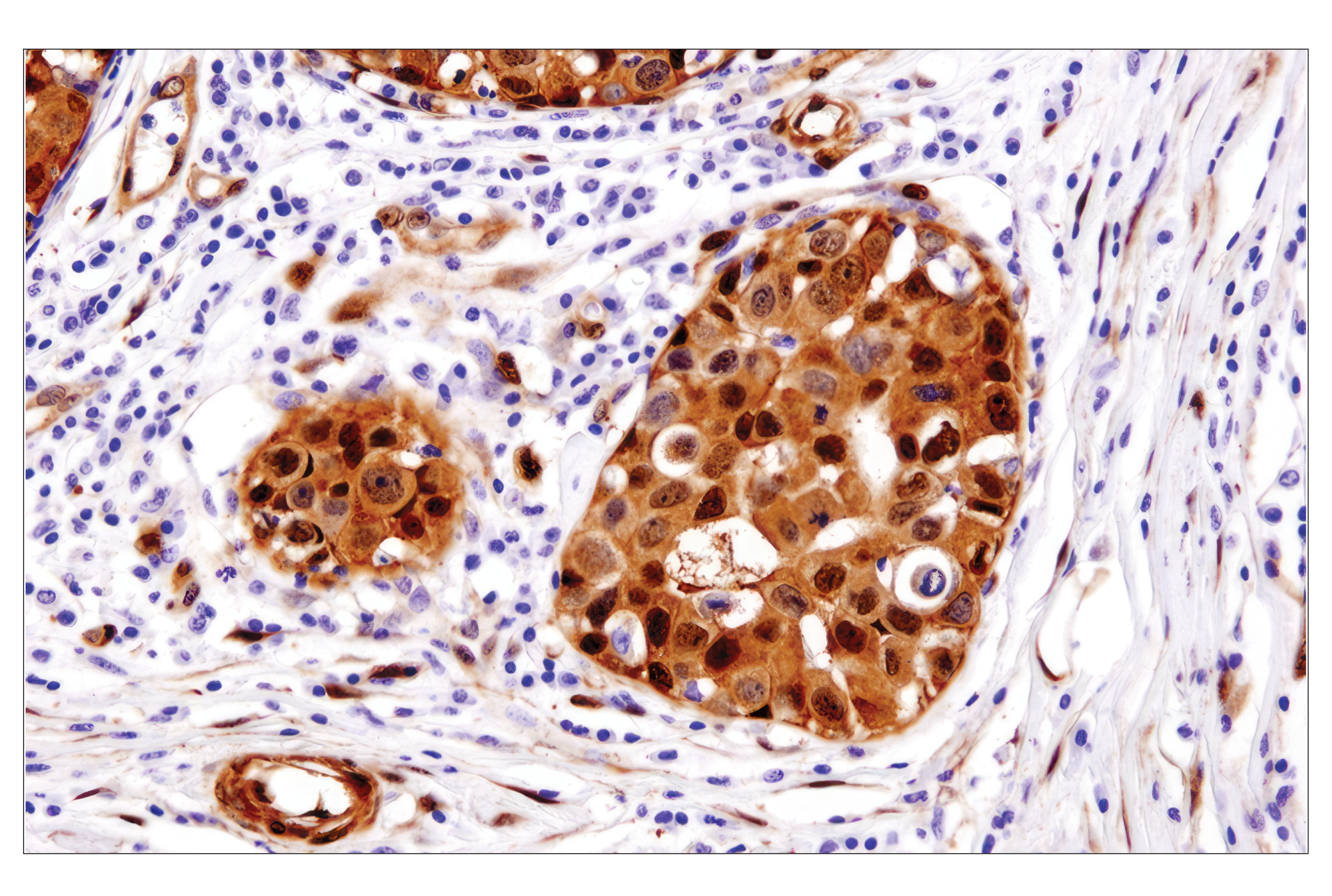 Hippo Pathway: Upstream Signaling Antibody Sampler Kit