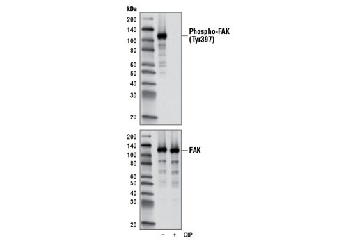 Angiogenesis Antibody Sampler Kit