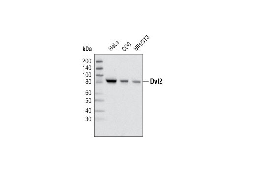 Wnt Signaling Antibody Sampler Kit