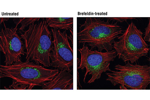 Exosomal Marker Antibody Sampler Kit