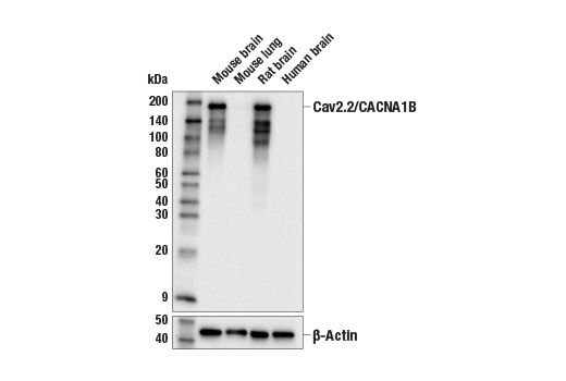 Cav2.2/CACNA1B (E2Q1Y) Rabbit mAb