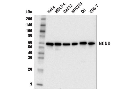 NONO (E8Q3E) Rabbit mAb