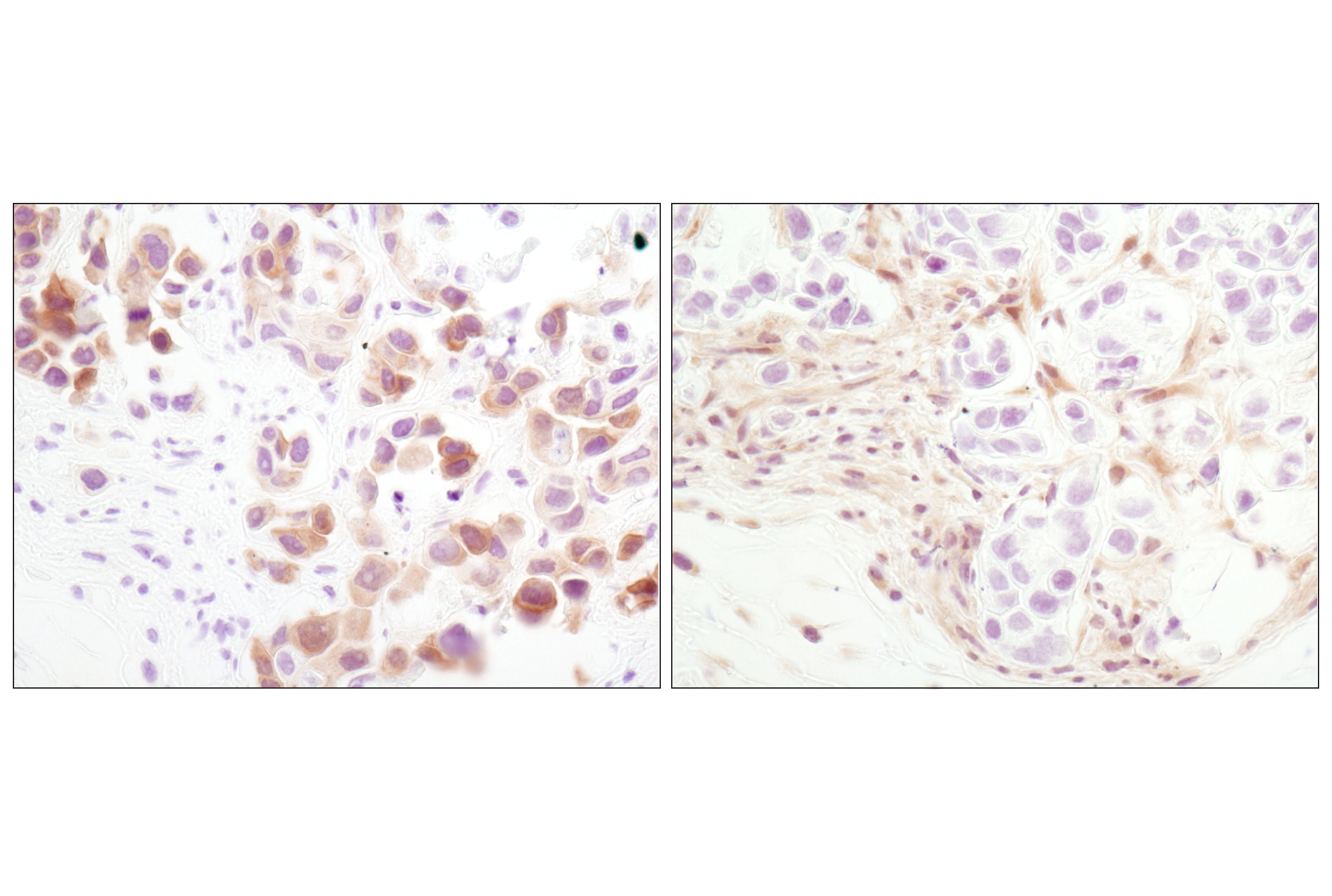 Angiogenesis Antibody Sampler Kit