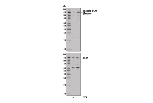 ULK1 Antibody Sampler Kit