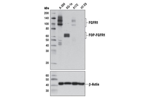 FGF Receptor 1 (D8E4) XP ®  Rabbit mAb