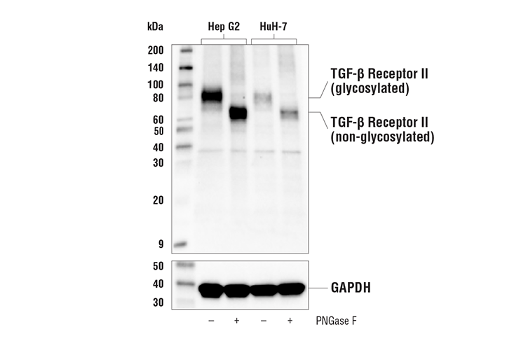 TGF-beta Receptor II (E5M6F) Rabbit mAb