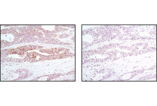 ER Stress-induced Autophagy Antibody Sampler Kit