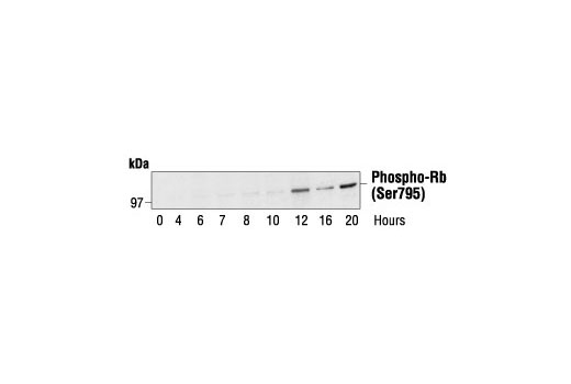 Phospho-Rb (Ser795) Antibody