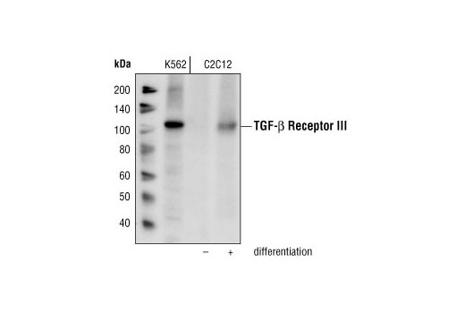 TGF-beta Receptor III Antibody