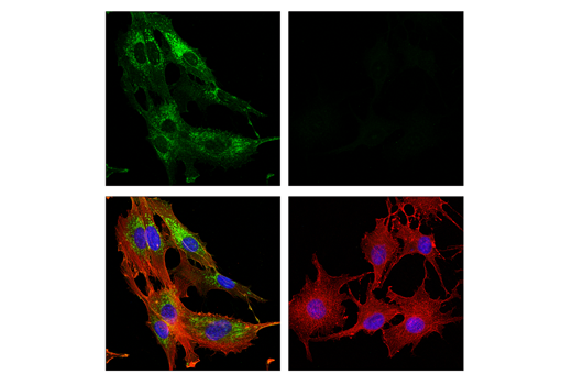 Cancer Associated Fibroblast Marker Antibody Sampler Kit