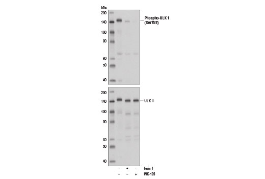 ULK1 Antibody Sampler Kit