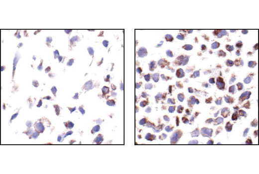 Pro-Apoptosis Bcl-2 Family Antibody Sampler Kit