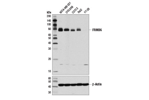 Hippo Pathway: Upstream Signaling Antibody Sampler Kit