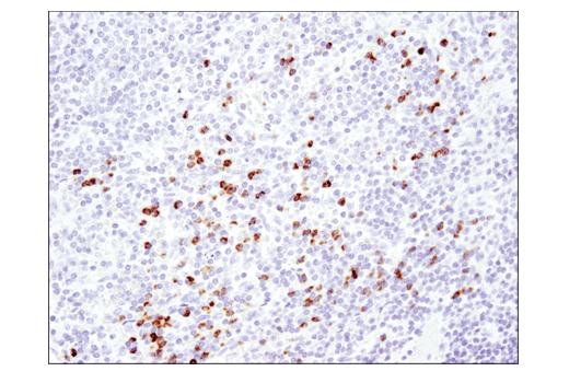 TGF-beta Fibrosis Pathway Antibody Sampler Kit