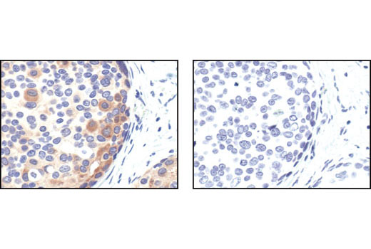 Pro-Apoptosis Bcl-2 Family Antibody Sampler Kit