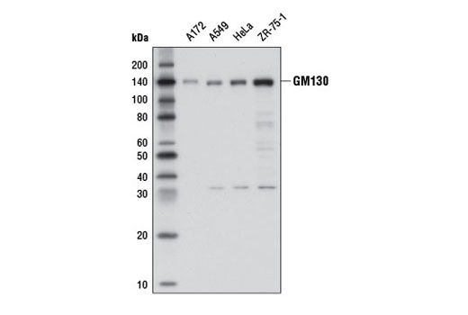 Exosomal Marker Antibody Sampler Kit