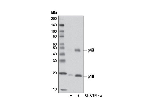 Apoptosis Antibody Sampler Kit (Mouse Preferred)