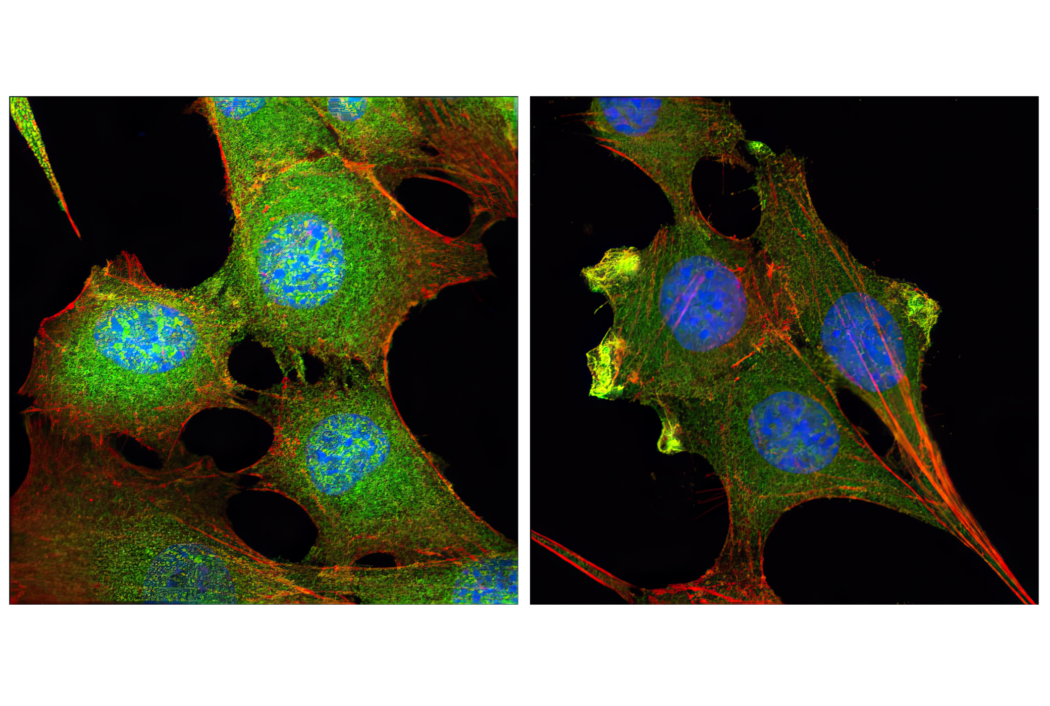 Phospho-Akt Isoform Antibody Sampler Kit