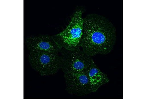 Exosomal Marker Antibody Sampler Kit