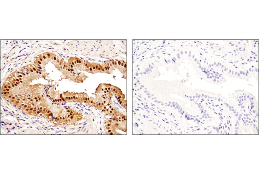 Human Reactive Cell Death and Autophagy Antibody Sampler Kit