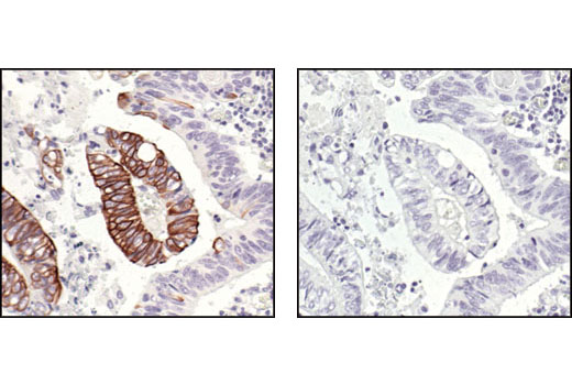 NF-kappaB Pathway Antibody Sampler Kit