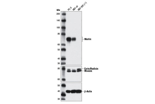 Hippo Pathway: Upstream Signaling Antibody Sampler Kit