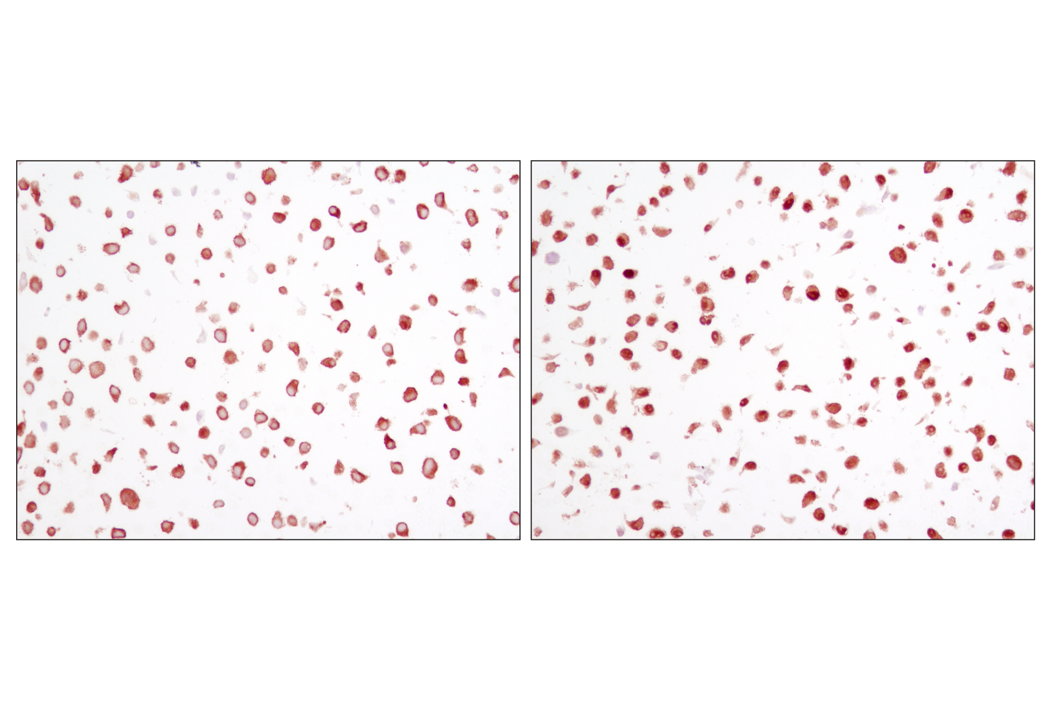 NF-kappaB Family Member Antibody Sampler Kit