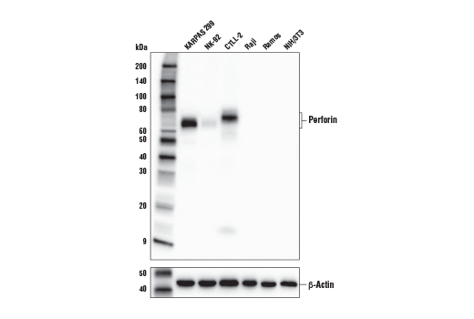 Perforin (E7D8R) Rabbit mAb
