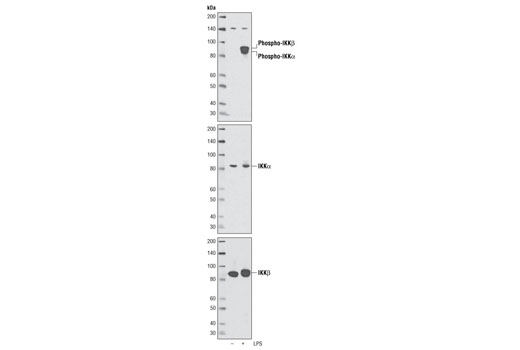 CST_Phospho-IKKalpha (Ser176)/IKKbeta (Ser177) (C84E11) Rabbit mAb_优宁维 ...